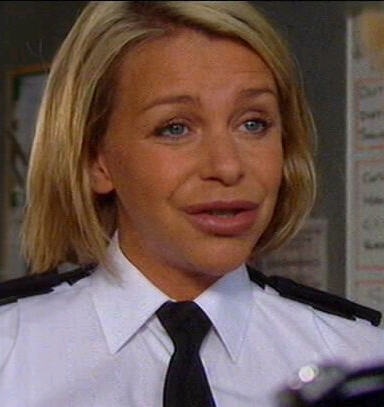 Leslie Ash - post silicone lip treatment